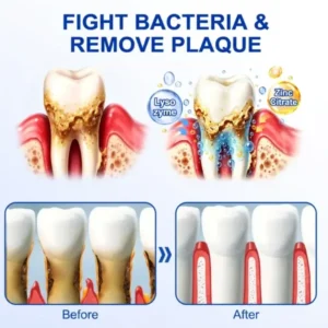 SOLAROZA® GumRevive Periodontal Repair Gel